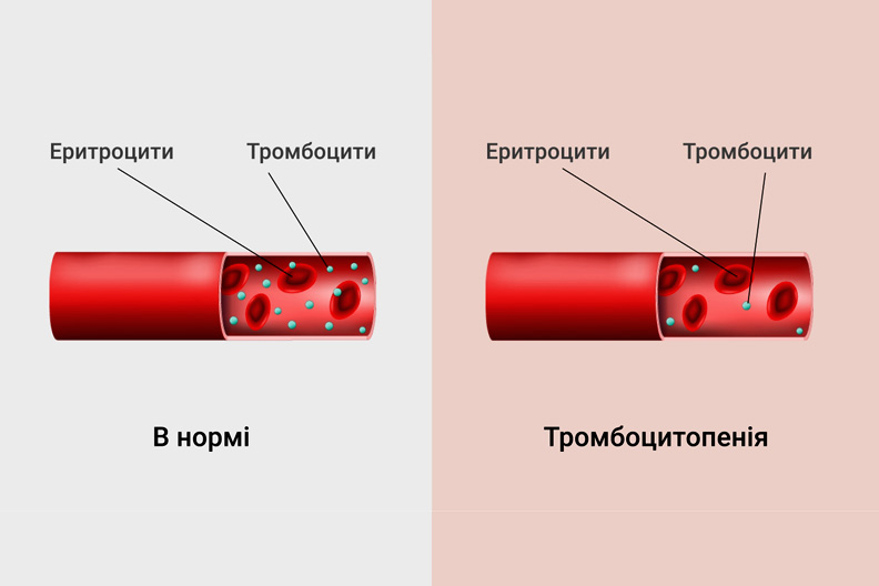 Тромбоциты